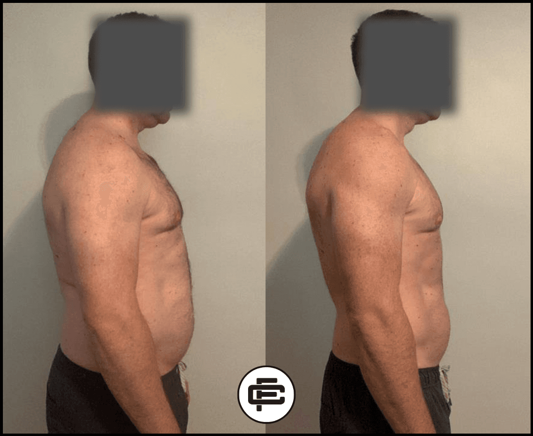 Client transformation
